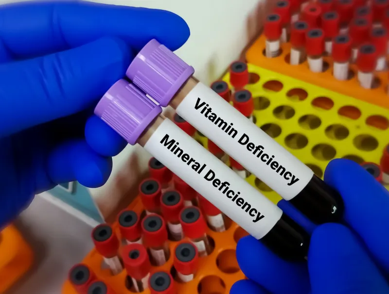 Hoe veelgebruikte medicijnen uw voedingsstoffen sluipend uitputten